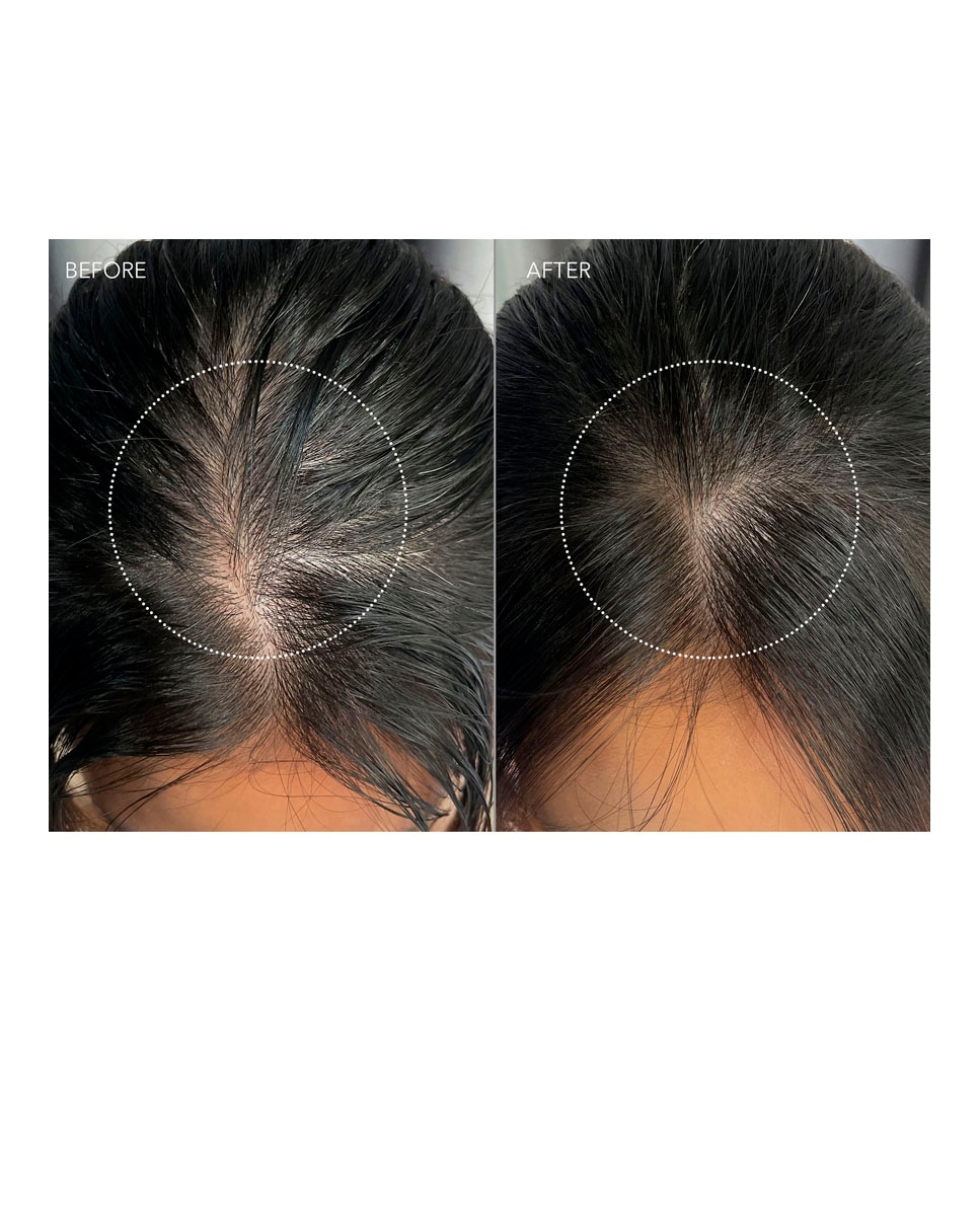 Sérum Para el Cuero Cabelludo Luna™ Dual-Peptide Scalp Serum Foreo 8