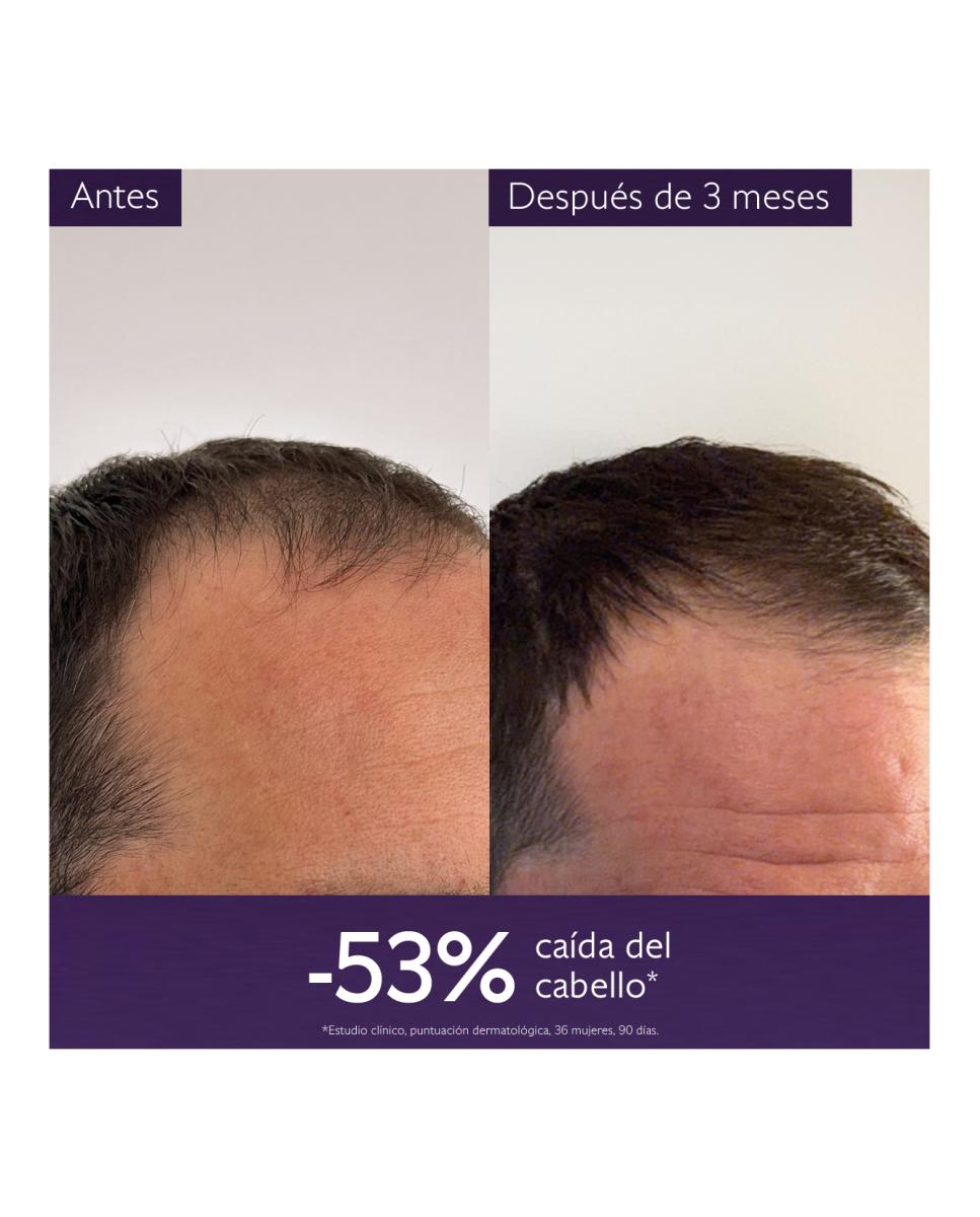 Sérum Capilar Anticaída 50 ml Caudalie 4