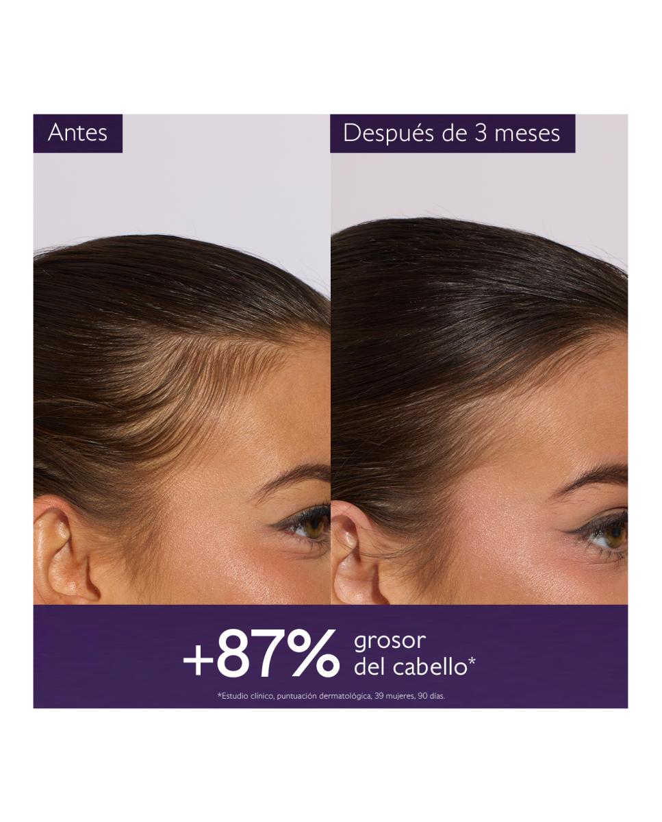 Sérum Capilar Anticaída 50 ml Caudalie 5