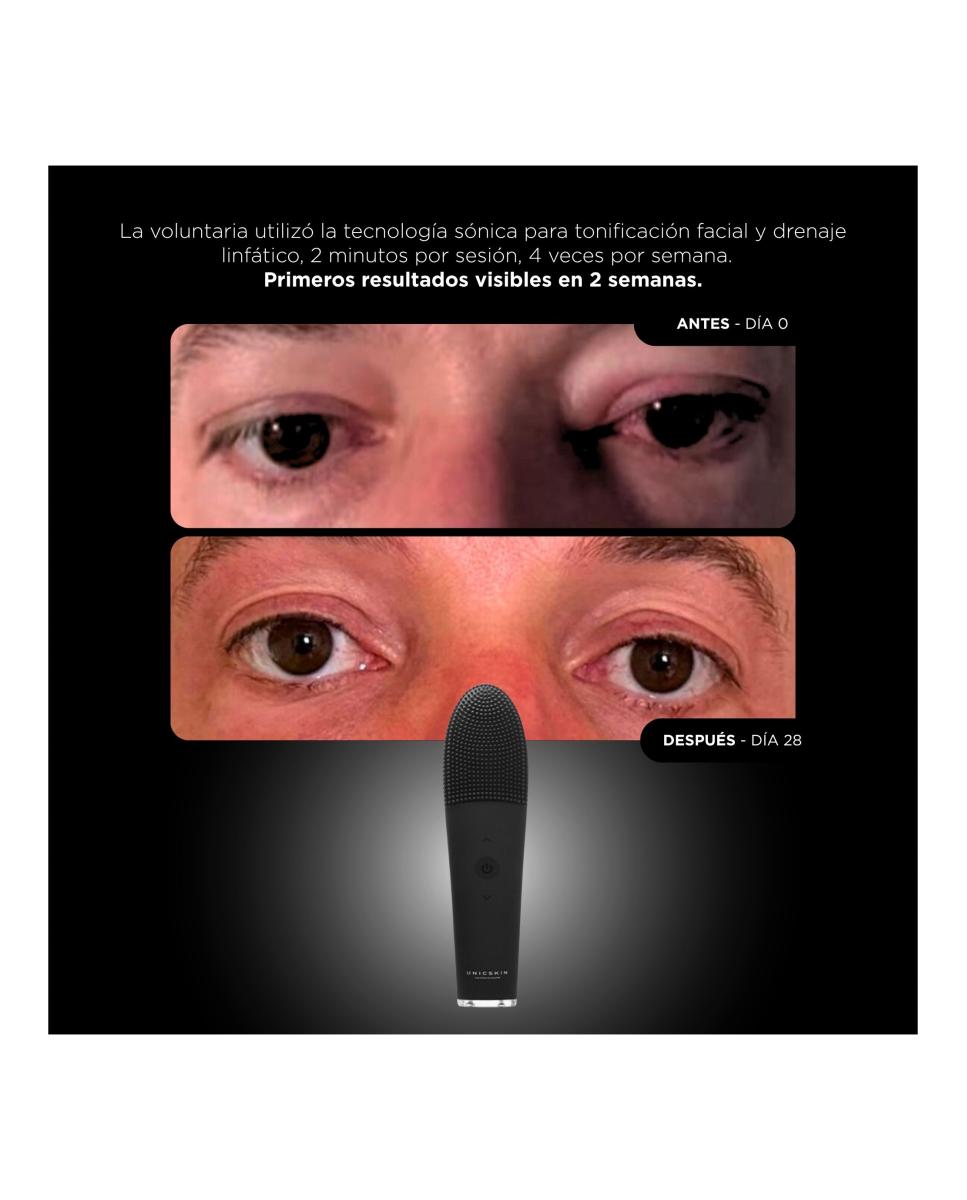 Unicthermo-Sonic 2.0 Dispositivo Facial 3-En-1 7