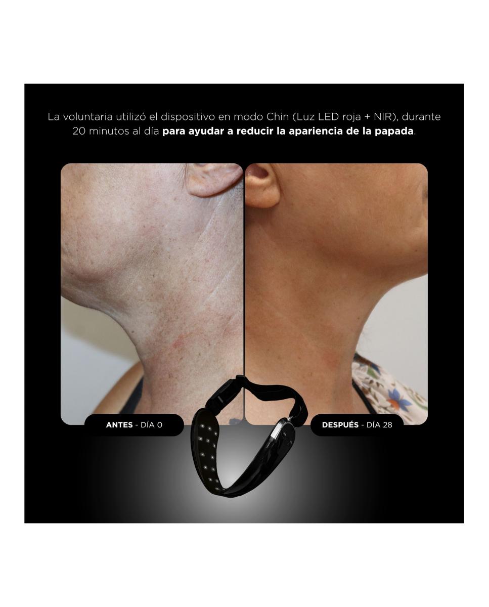 Unicled Neck & Chin Mask Dispositivo Rejuvenecedor Con Tecnología Led 7