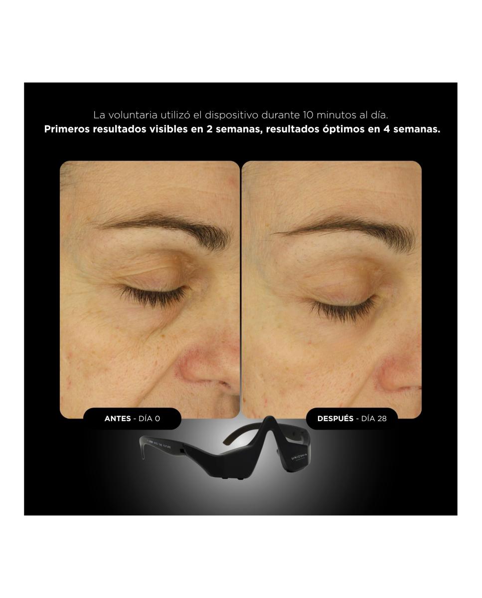 Unictech Eye Mask  Dispositivo De Doble Tecnología Contorno Ojos 7