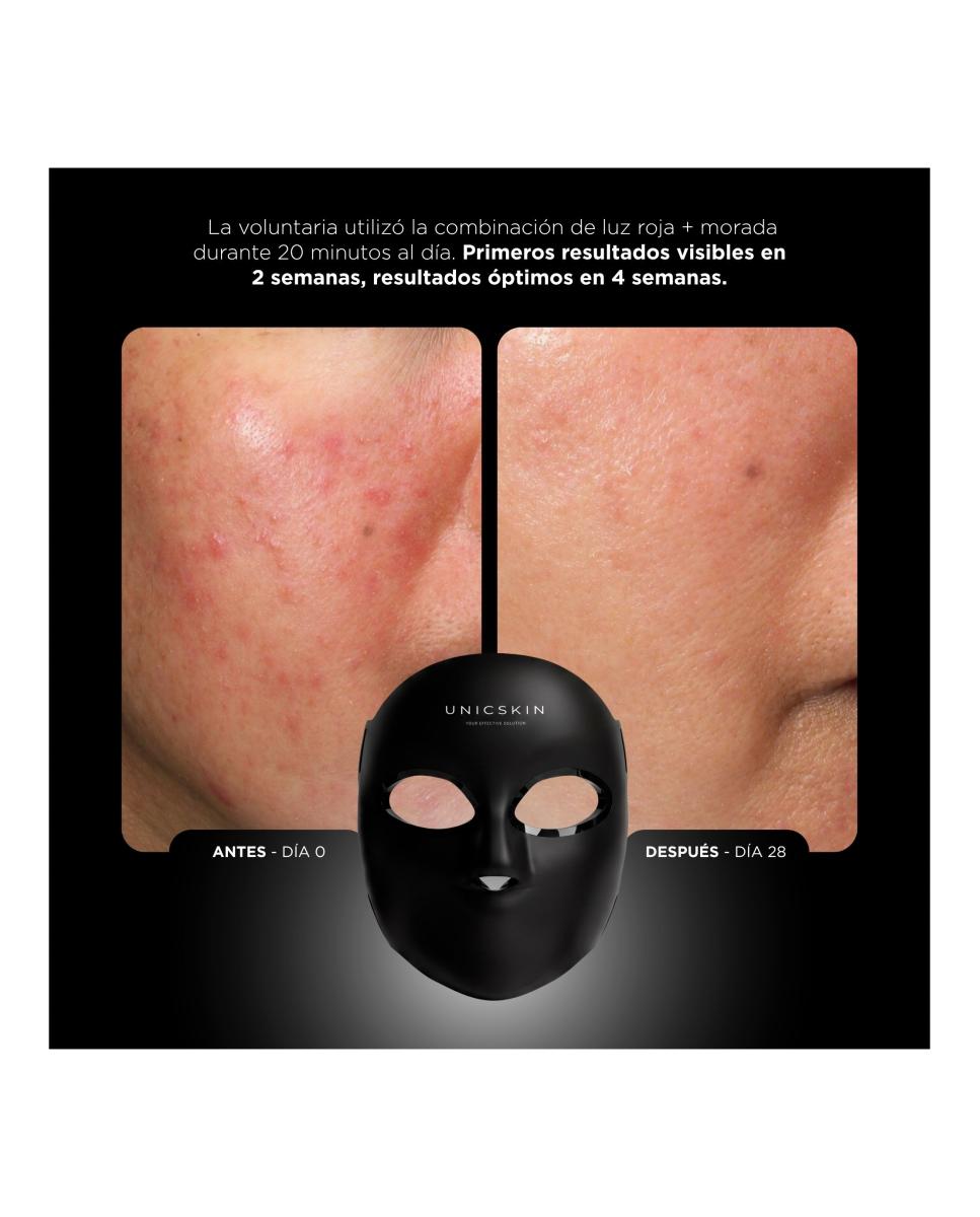 Unicled Centurion Korean Mask 5.0  Máscara Facial Con Tecnología Led  Nir  Ia 9