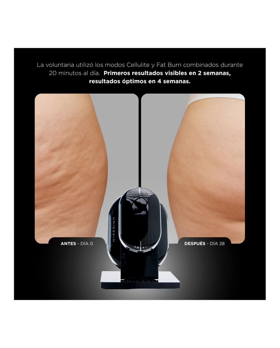 Unictech Body Slim X4 Dispositivo Corporal 4-En-1 7