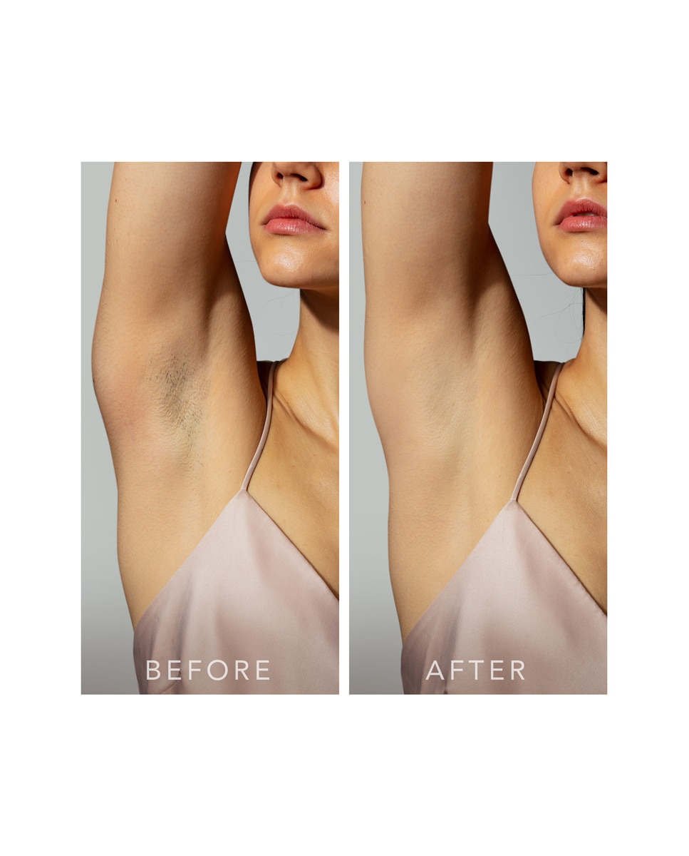 ™ 2 - Dispositivo IPL de depilación definitiva con sistema de enfriamiento de la piel FOREO - Peach Peach-5