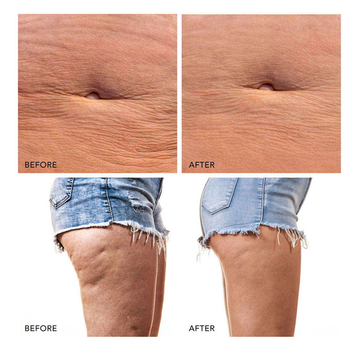 BEAR™ 2 body Dispositivo corporal de microcorrientes Lavender FOREO - Lavender Lavender-6