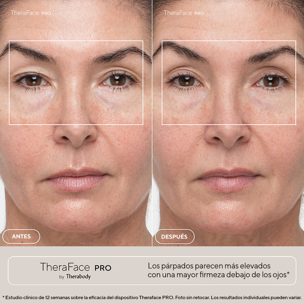 Theraface PRO Dispositivo de Tonificação Facial Preto-19