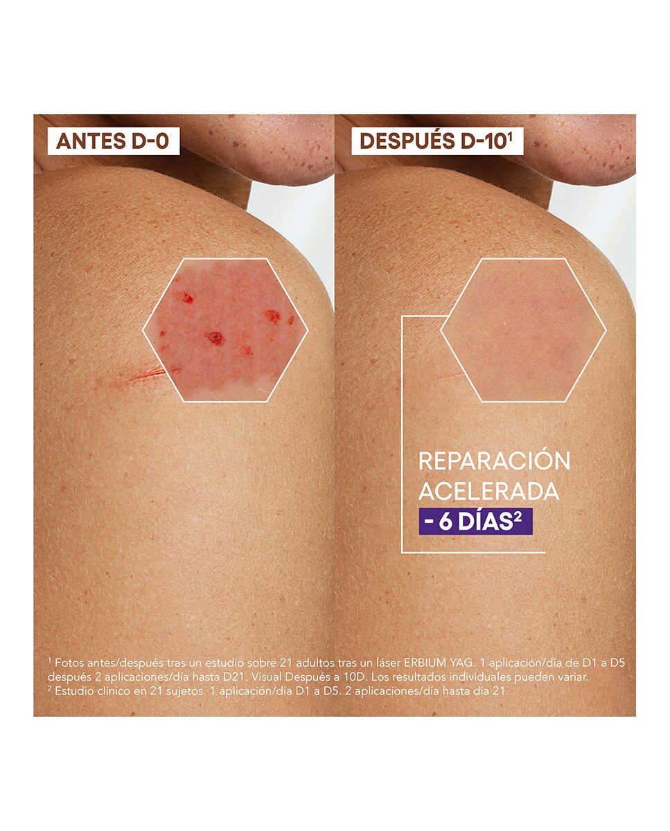 Creme Epitheliale Ultra Repair 2