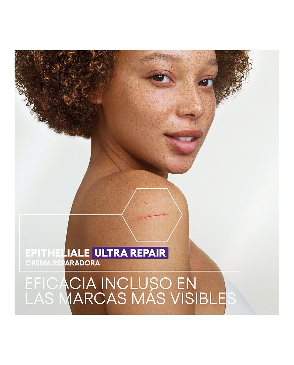 Creme Epitheliale Ultra Repair 4