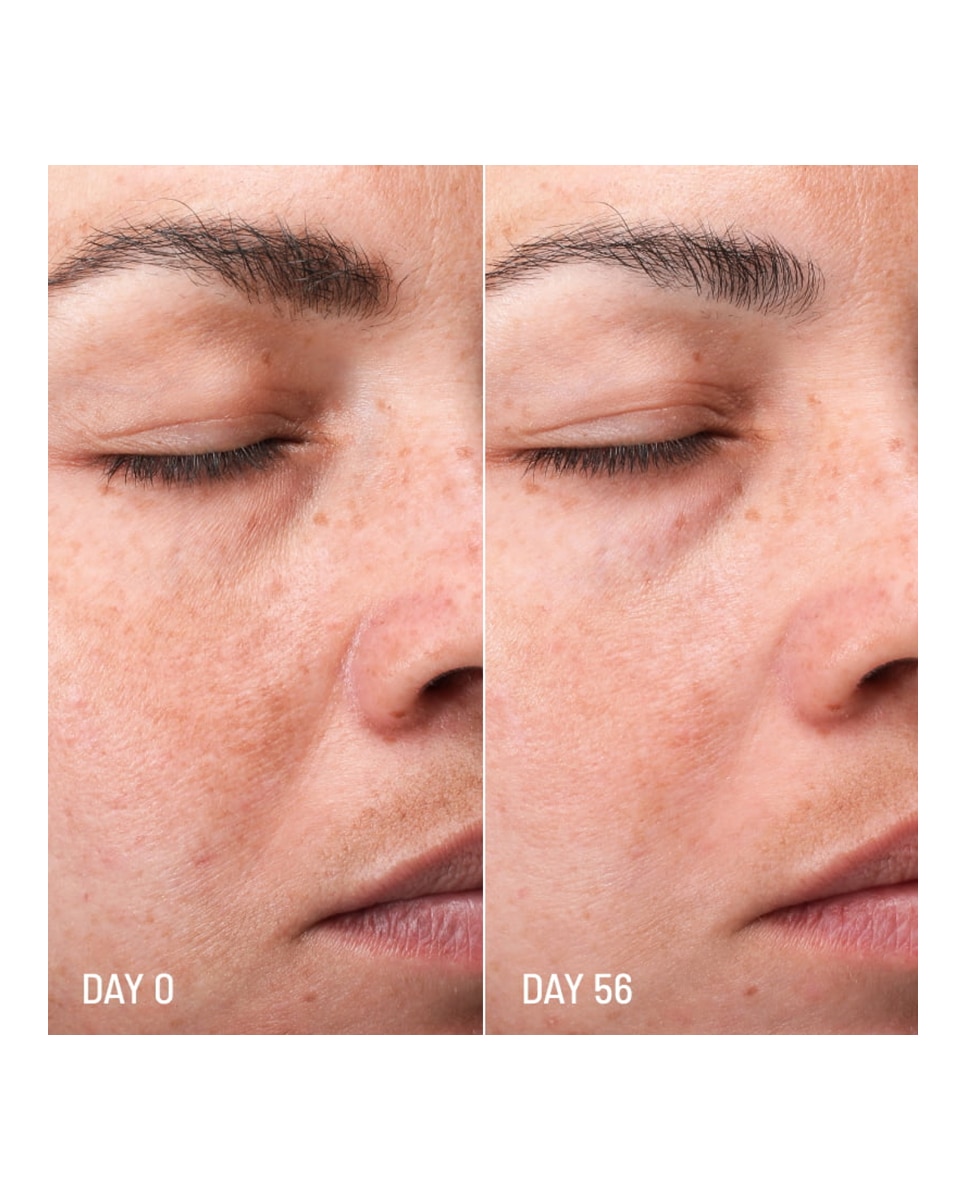Imagen 7 de Tratamiento despigmentante Lotus Radiance Darkspot Treatment 50 ml Freshly Cosmetics - 50 ml