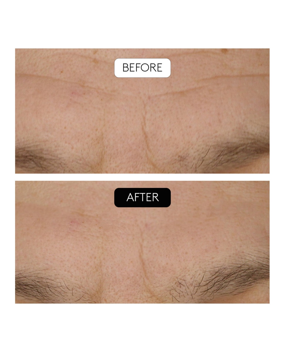 Imagen 5 de Sérum Antiarrugas Clinical Beauty Filler Cocunat