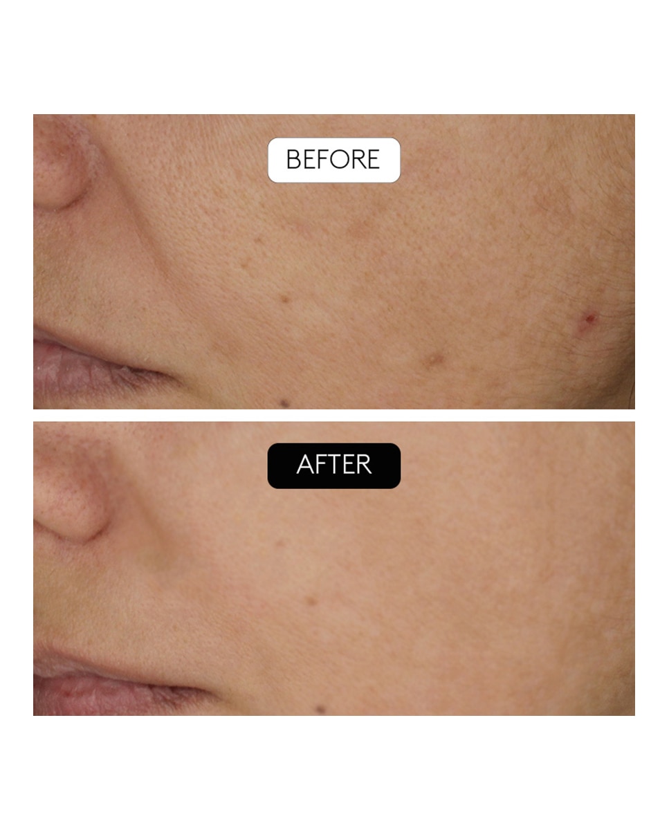 Imagen 6 de Sérum Antiarrugas Clinical Beauty Filler Cocunat