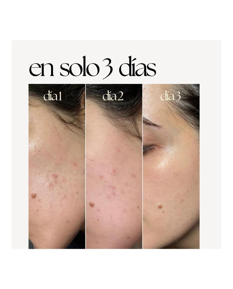 Imagen 4 de Sérum Skin Correct Sérum 30 Ml Elisabeth Álvarez Cosmetics