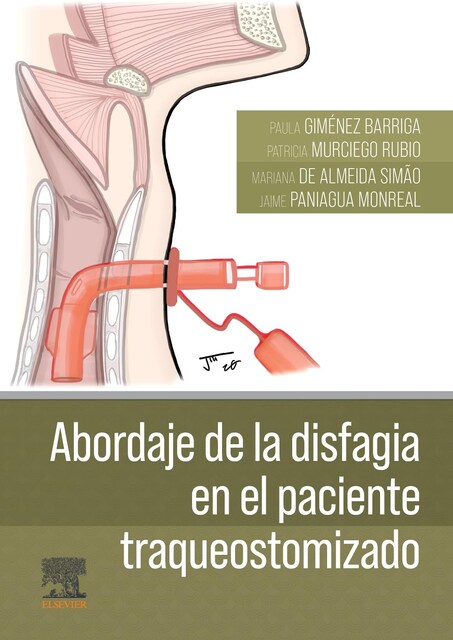 Imagen 0 de Abordaje de la disfagia en el paciente traqueostomizado (Tapa blanda)