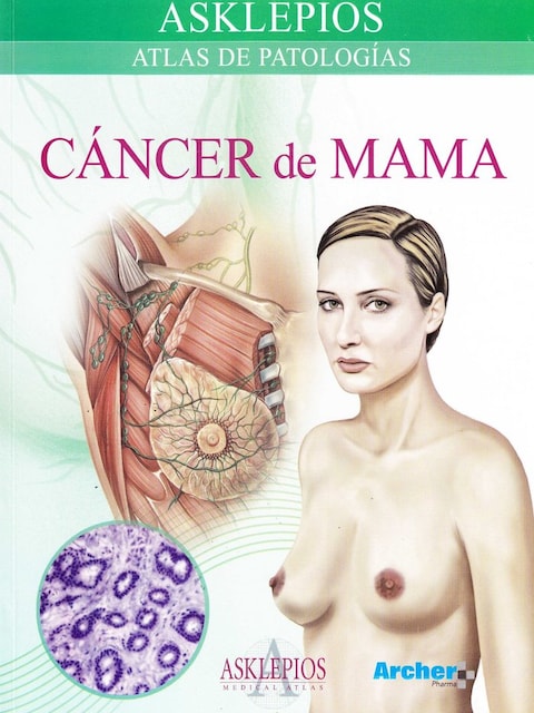 Imagen 0 de Cáncer de mama